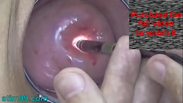 Hot Endoscope Camera inside Cervix Cam into Pussy Uterus drive Movies