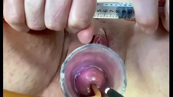 Hot Extreme w inflation of catheter balloon in cervix drive Movies