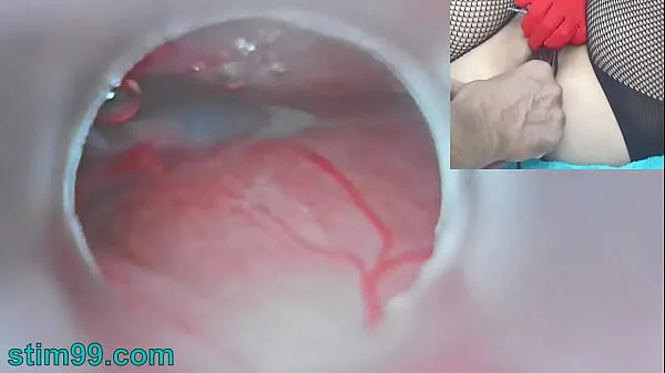 Hot Uncensored Japanese Insemination with Cum into Uterus and Endoscope Camera by Cervix to watch inside womb drive Movies